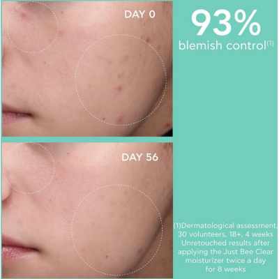 Comprar APIVITA JUST BEE CLEAR GEL-CREMA ANTI-IMPERFECCIONES MATIFICANTE HIDRATANTE 40 ML al mejor precio en NuestraFarma, tu farmacia online