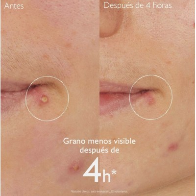 Comprar CAUDALIE VINOPURE STOP GRANOS CON ACIDO SALICÍLICO 15 ML al mejor precio en NuestraFarma, tu farmacia online